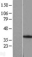 ANKRA2 Human Over-expression Lysate