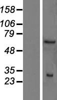 Gemin 1 (SMN2) Human Over-expression Lysate