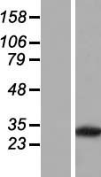 PVRIG Human Over-expression Lysate