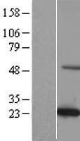 C19orf50 (KXD1) Human Over-expression Lysate