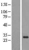 OBFC2B (NABP2) Human Over-expression Lysate