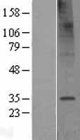 TMEM106C Human Over-expression Lysate