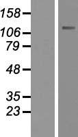 CARD14 Human Over-expression Lysate