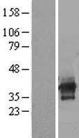 ILRUN Human Over-expression Lysate