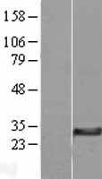 DHRS11 Human Over-expression Lysate