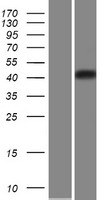 CHST5 Human Over-expression Lysate