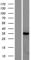 RNASEH2B Human Over-expression Lysate