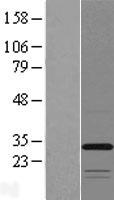 TMEM53 Human Over-expression Lysate