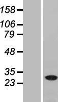 NAA40 Human Over-expression Lysate