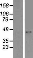 ABHD9 (EPHX3) Human Over-expression Lysate