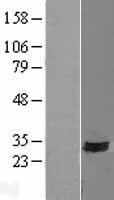 TMEM90B (SYNDIG1) Human Over-expression Lysate