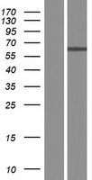 ZCCHC4 Human Over-expression Lysate