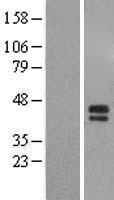 ST6GALNAC5 Human Over-expression Lysate