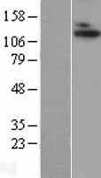 ADAMTS10 Human Over-expression Lysate