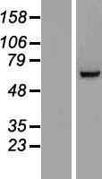 TIGD6 Human Over-expression Lysate