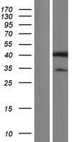 HNRPAB (HNRNPAB) Human Over-expression Lysate