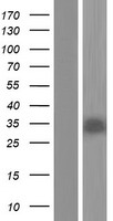 SIRT5 Human Over-expression Lysate