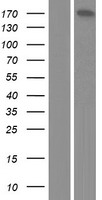 BRCAA1 (ARID4B) Human Over-expression Lysate