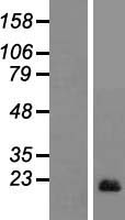 AIF1L Human Over-expression Lysate