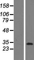 Coiled Coil Domain Containing Protein 3 (CCDC3) Human Over-expression Lysate