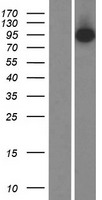 ZMIZ2 Human Over-expression Lysate