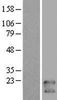 TMEM47 Human Over-expression Lysate