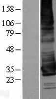 KCNK17 Human Over-expression Lysate