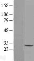 CD99L2 Human Over-expression Lysate