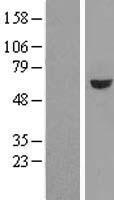 GRWD1 Human Over-expression Lysate