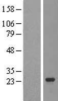 TRPT1 Human Over-expression Lysate