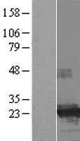 FTHL17 Human Over-expression Lysate