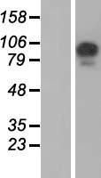 USP26 Human Over-expression Lysate