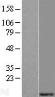 MRPS21 Human Over-expression Lysate