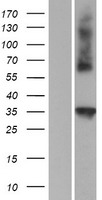 CTRP4 (C1QTNF4) Human Over-expression Lysate
