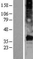 TMEM120A Human Over-expression Lysate