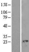 AKAP associated Sperm Protein (ROPN1L) Human Over-expression Lysate