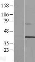 TTC29 Human Over-expression Lysate