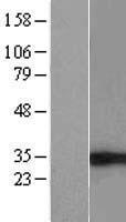 EIF4H Human Over-expression Lysate