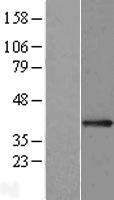 OTP Human Over-expression Lysate