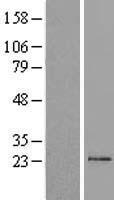TM2D1 Human Over-expression Lysate