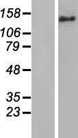 BRIP1 Human Over-expression Lysate