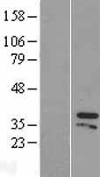 ZIC4 Human Over-expression Lysate