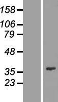 FYTTD1 Human Over-expression Lysate