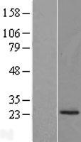 PRADC1 Human Over-expression Lysate