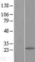 EIF1AD Human Over-expression Lysate