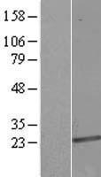 VPS25 Human Over-expression Lysate