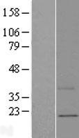 MNF1 (UQCC2) Human Over-expression Lysate