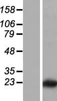 LLPH Human Over-expression Lysate