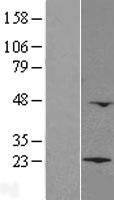 LZIC Human Over-expression Lysate