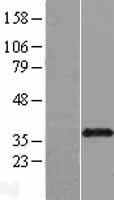 NIFK Human Over-expression Lysate